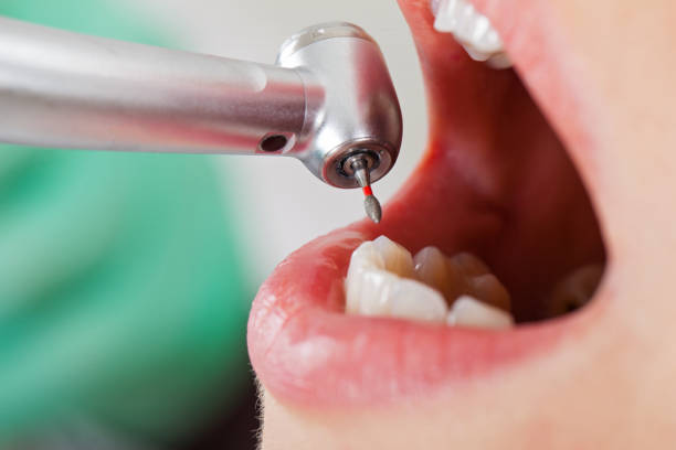 Best Urgent Tooth Repair  in Seguin, TX